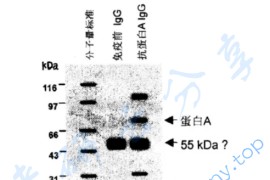 2006年中国科学院大学852细胞生物学考研真题